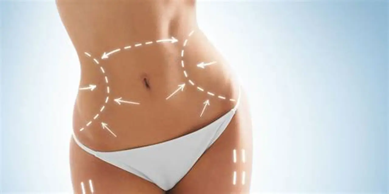 Body contouring